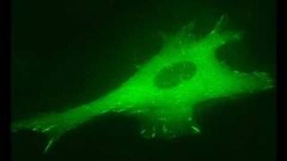 Actin Filament Induced Movement II Cell Adhesion [upl. by Darin209]