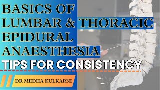 Mastering Epidural Anesthesia Essential Tips for Consistency I Dr Medha Kulkarni [upl. by Pozzy]