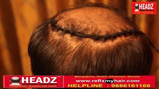 Hair Weaving in Chennai  Wig in Chennai Tamilnadu  Hair Patch for Men in Chennai Call 9087861166 [upl. by Marna]