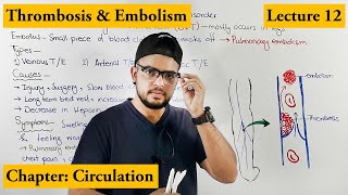 Thrombosis amp Embolism Cardiovascular Disorder  Chapter circulation  Video  12 [upl. by Sirehc]