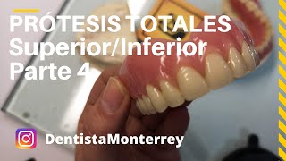 PASOS Prácticos PrótesisTotales👅Parte4 Prueba dientesAjustesPrótesisTerminada DentaduraCompleta [upl. by Alis]