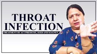 Treatment of Throat Infection by acupressure seed and magnet therapy [upl. by Munniks]