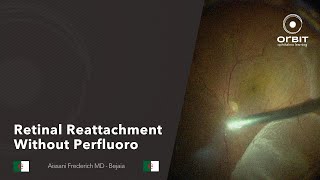 Retinal reattachment without perfluoro [upl. by Poucher422]