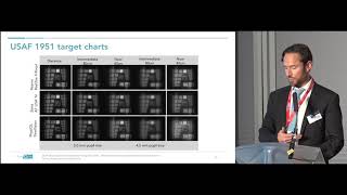 Visual Outcomes With the RayOne Trifocal IOL by Allon Barsam MD MA FRCOphth [upl. by Rialcnis]