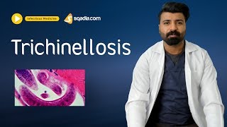 Trichinellosis  Infectious Disease Video Lectures  Medical Education  VLearning [upl. by Goodden]