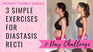 Get Rid Of Mommy Tummy with 3 Simple Diastasis Recti Exercises  7 Day Challenge [upl. by Osborn485]