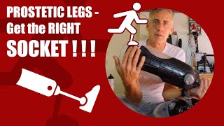 AMPUTEE and Prosthetic Leg Socket [upl. by Les]