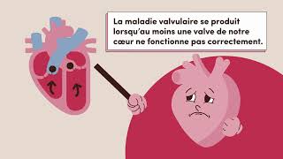 Semaine de sensibilisation aux maladies valvulaires 2024 [upl. by Aleiram808]