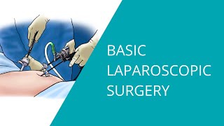 Basic Laparoscopic Surgery [upl. by Kciredorb]