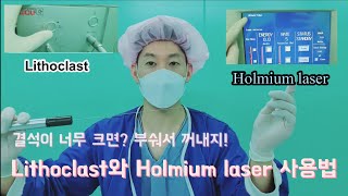 Lithoclast와 Holmium laser 사용법 [upl. by Oecam]