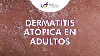 Dermatitis Atópica en Adultos [upl. by Thgiled176]