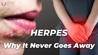 Why Herpes never goes away  The Institute of Human Anatomy [upl. by Obocaj]