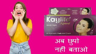 Kaylite Ayurveda Natural Face Cream  kaylite cream review  kaylite cream uses in hindi [upl. by Rachaba]