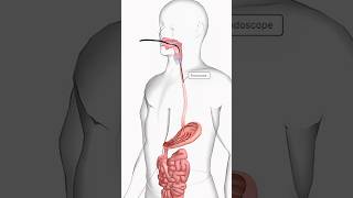 Endoscopy anatomy health 3danatomy [upl. by Knute]