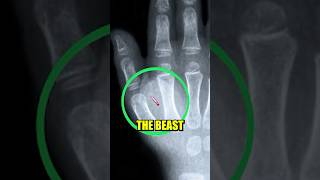 The UNTOLD Truth About The Mark Of The Beast bible bibleexplained ytviral [upl. by Aralk341]