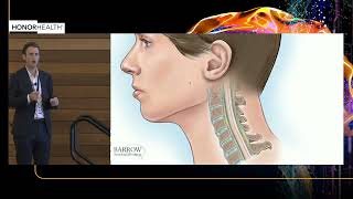 Cervical Myelopathy amp Radiculopathy  Core Knowledge for Management and Surgical Treatment [upl. by Narot801]