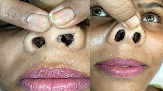 Nose hair cutting and nose massagenosePignosehaircutting piggynosemassage pummybeautyworld [upl. by Rebe]