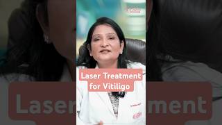 How to treat vitiligo  Laser treatment for vitiligo  Dermatologist in Ludhiana [upl. by Eidas]