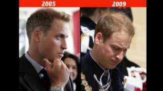 Prince Williams beauty before  after Kate in pictures [upl. by Aerdnahc433]