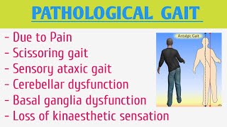 Pathological Gait [upl. by Namlak815]