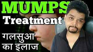 Mumps Treatment CausesSymptoms In Hindi [upl. by Tolley]