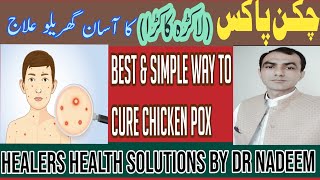 Chicken pox treatment ampprecaustions [upl. by Arob]