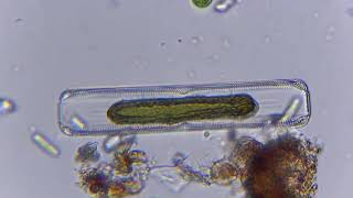 Pinnularia diatom [upl. by Callan340]