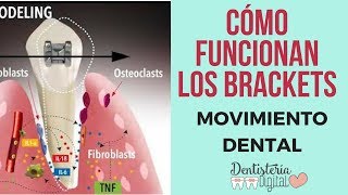 CÓMO FUNCIONAN LOS BRACKETS  Movimiento Dental [upl. by Krispin767]