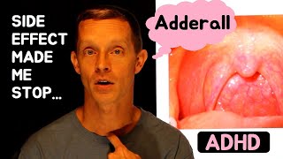 Side Effect of Adderall Made Me Stop  Dry Mouth amp Sore Throat  ADHD [upl. by Assir]