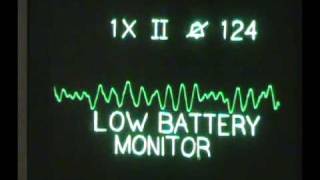 ACLS Algorithms  Ventricular Fibrillation  Sacramento Class [upl. by Adianes]