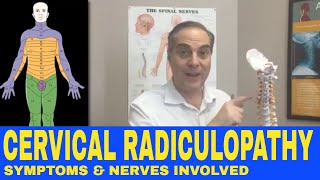 Cervical Radiculopathy Symptoms Nerve Chart Nerve Distribution  Dr Walter Salubro [upl. by Saum]