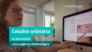 Celulite orbitária ou pósseptal uma urgência oftalmológica [upl. by Ycnej]