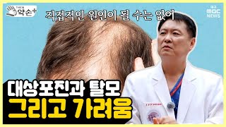 대상포진과 탈모 그리고 가려움 통증의 공포 대상포진⑨  메디컬 약손 [upl. by Ahsenhoj]