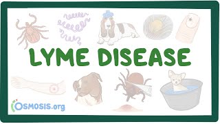 Lyme disease  causes symptoms diagnosis treatment pathology [upl. by Sharyl501]