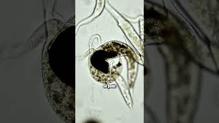 Dois protozoários caçadores disputam a mesma presa microbiologia microorganismos [upl. by Cardon]