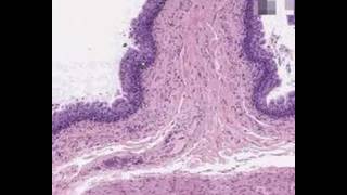 Shotgun Histology Bladder [upl. by Earized]