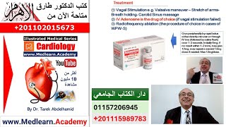 Supraventricular Tachycardia SVT cme internalmedicine medical usmle محاضراتباطنة [upl. by Dielle591]