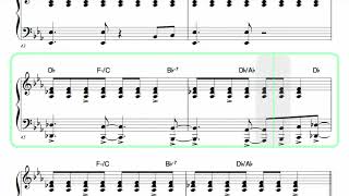 SUPERTRAMP ● The Logical Song  Isolated Keyboard 1  SCORE [upl. by Ryun]