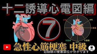 急性心筋梗塞⑦中級編 冠動脈の梗塞部位が分かります [upl. by Storz595]