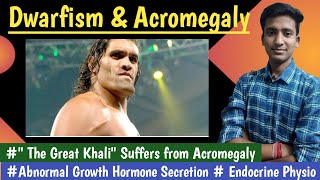 Acromegaly amp Dwarfism amp Gigantism  Growth HormoneEndocrine Physiology  in hindi Ashish [upl. by Assehc]