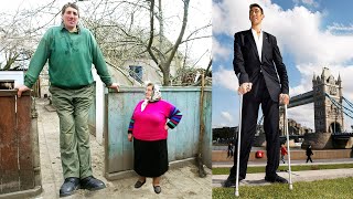 The TALLEST PEOPLE In The World [upl. by Daughtry219]