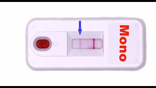 Rapid Mono Test How Does it Work [upl. by Frances]