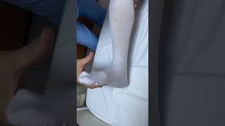 Clonus reflex involving the achilles tendon Aşil klonus refleksi [upl. by Lardner]