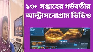 ১৩ সপ্তাহের আল্ট্রাসনোগ্রাম ভিডিও দেখে নিন।pregnancy pregnancyultrasound usg earlypregnancy dr [upl. by Sugden438]