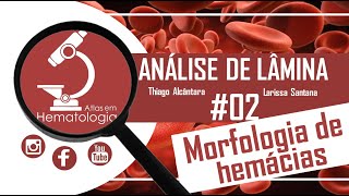 Análise de lâmina 02Morfologia de hemácias [upl. by Atsugua]