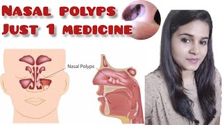 Homeopathic medicine for nasal polyps [upl. by Yellah949]