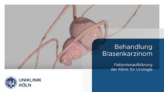 Blasenkrebs  Blasenkarzinom Behandlung Klinik für Urologie Patienteninformation  Uniklinik Köln [upl. by Aynekal]