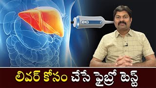 Fibroscan Test For Liver  లివర్ కోసం చేసే ఫైబ్రో స్కాన్ టెస్ట్ [upl. by Wolpert]