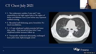 Central Valley Chronicles Challenging Coccidiomycosis Cases in PWH [upl. by Eadahc]