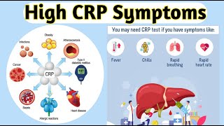 High crp symptoms [upl. by Pepita]